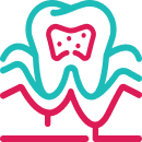 Cavity Gum Disease
