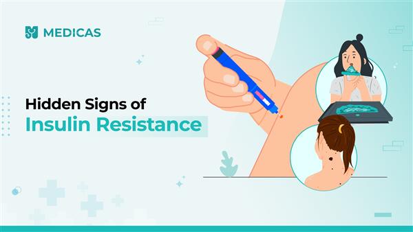 Silent Symptoms of Insulin Resistance