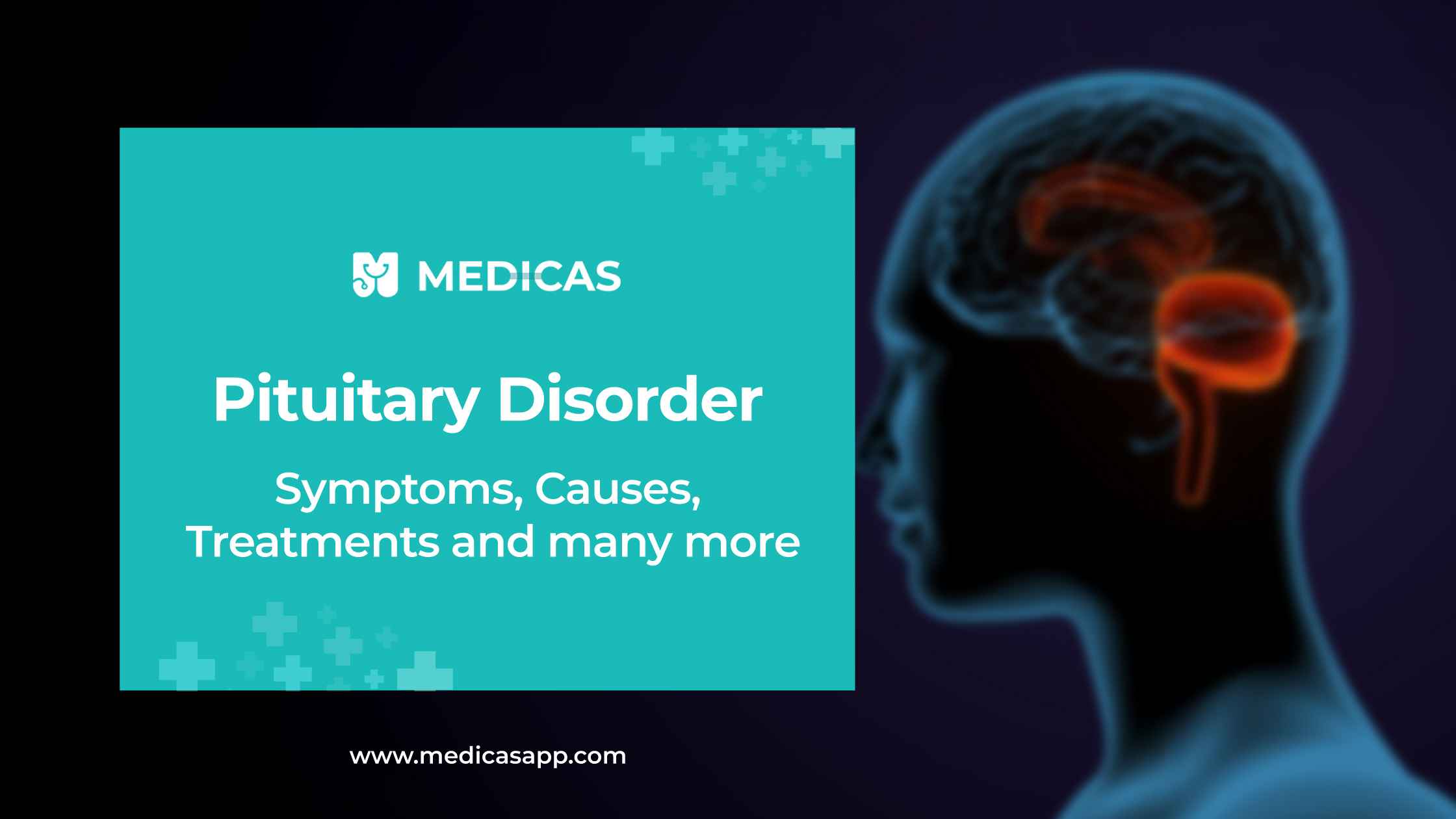 Pituitary Disorder: Causes, Symptioms and Treatment